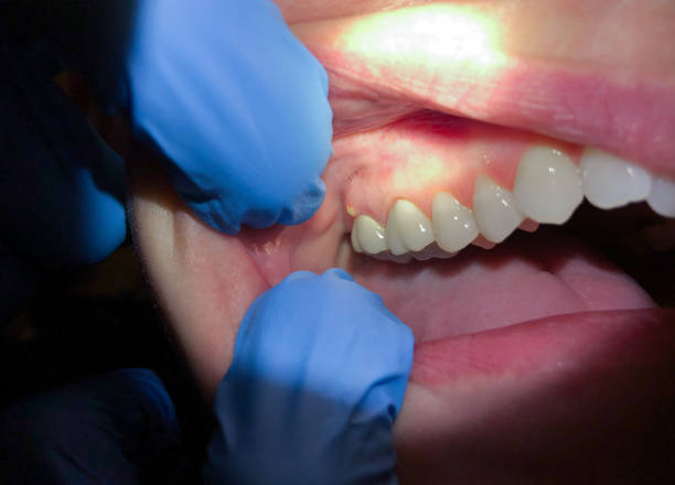 Best 24-Hour Emergency Dental Care in Dutch Island, GA