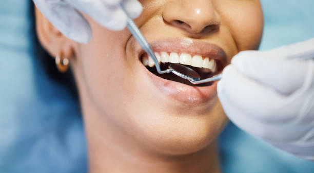Best Emergency Denture Repair in Dutch Island, GA